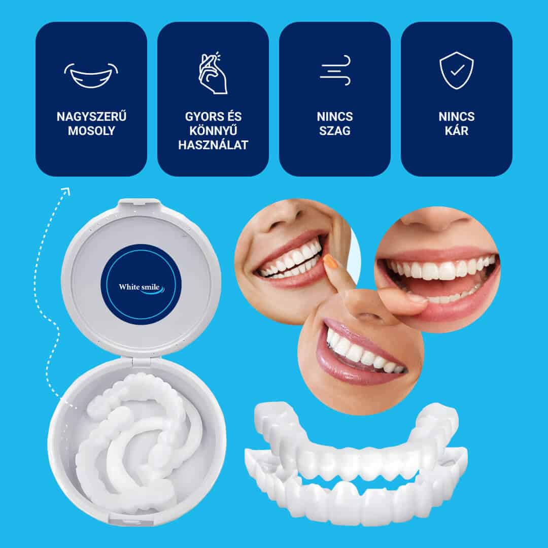 WHITESMILE™ – Állítható Kozmetikai Foghéj - Image 6