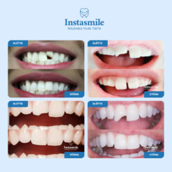 Alternative view of INSTASMILE FOGÁSZATI JAVÍTÓ KÉSZLET
