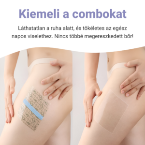 Alternative view of THAILIFT™ COMBEMELŐ MATRICÁK - 10 DB.